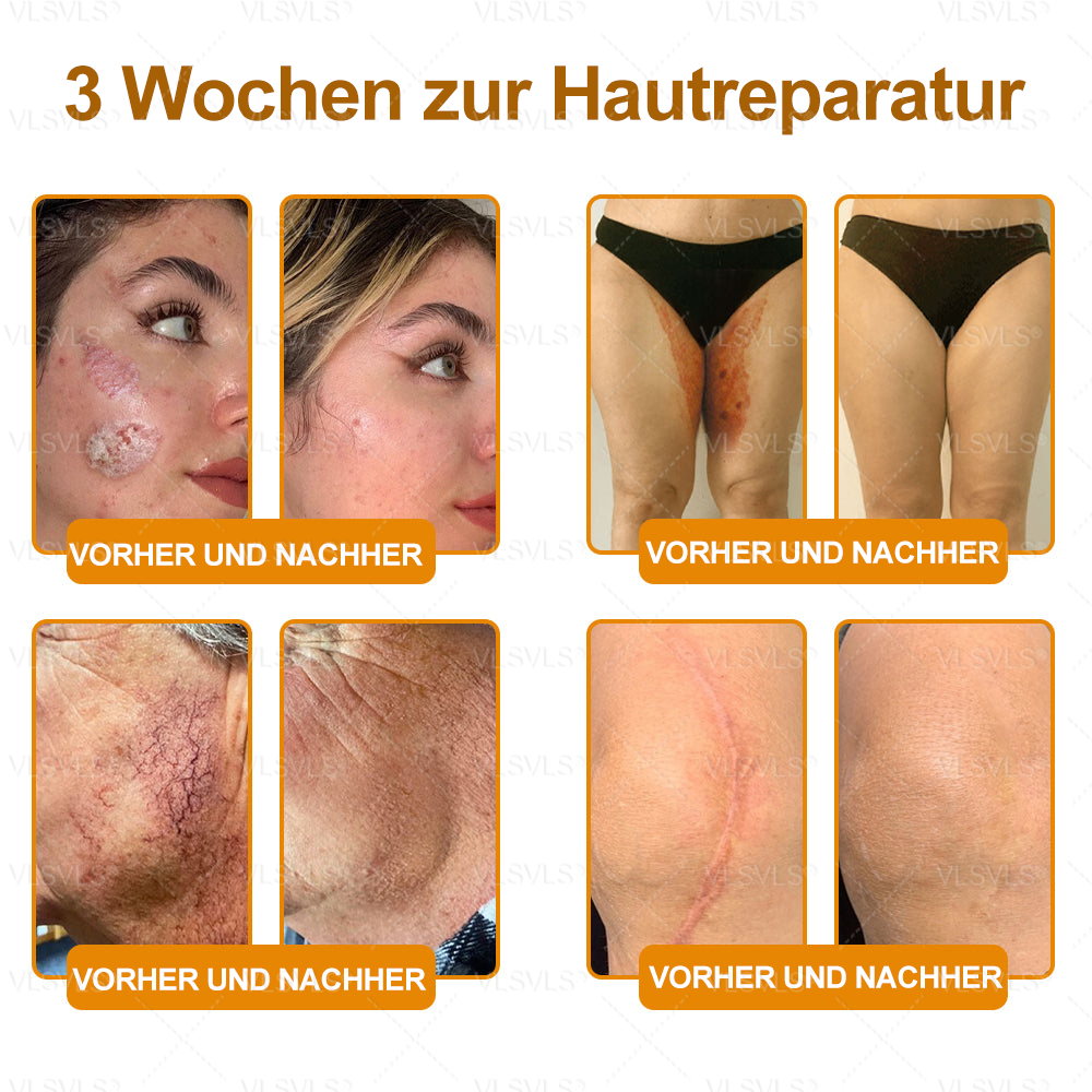 Hergestellt und versendet aus Deutschland ✨VLSVLS® BIENENGIFT Hautregenerationscreme 🔥 LETZTER TAG 80 % RABATT🌟