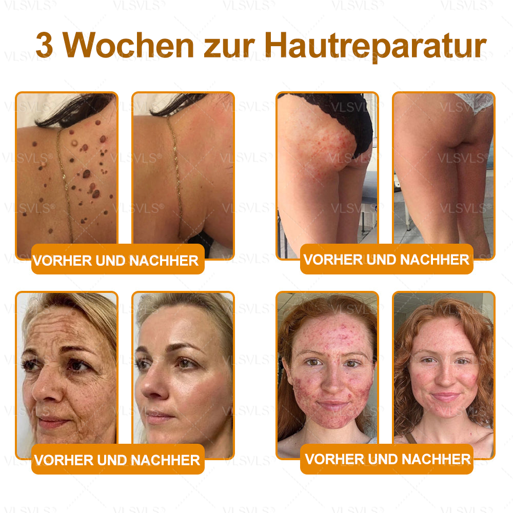 Hergestellt und versendet aus Deutschland ✨VLSVLS® BIENENGIFT Hautregenerationscreme 🔥 LETZTER TAG 80 % RABATT🌟