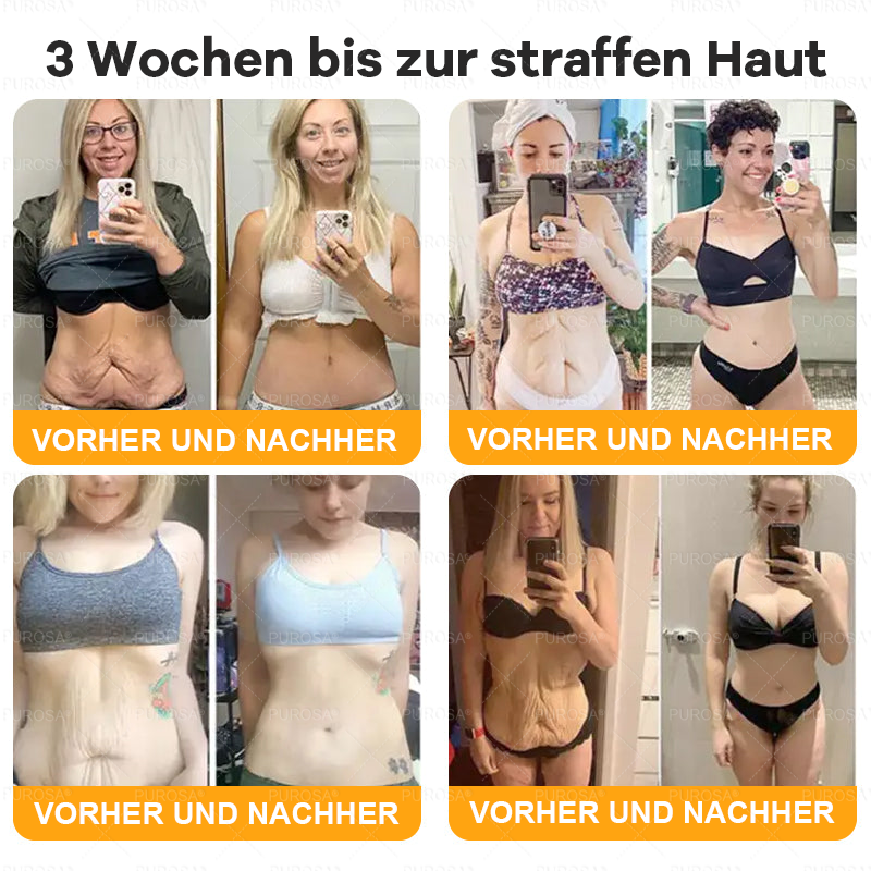 Hergestellt und versendet aus Deutschland ✨VLSVLS® BIENENGIFT Hautregenerationscreme 🔥 LETZTER TAG 80 % RABATT🌟