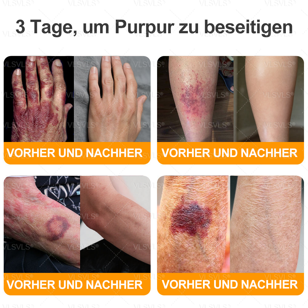 Hergestellt und versendet aus Deutschland ✨VLSVLS® BIENENGIFT Hautregenerationscreme 🔥 LETZTER TAG 80 % RABATT🌟