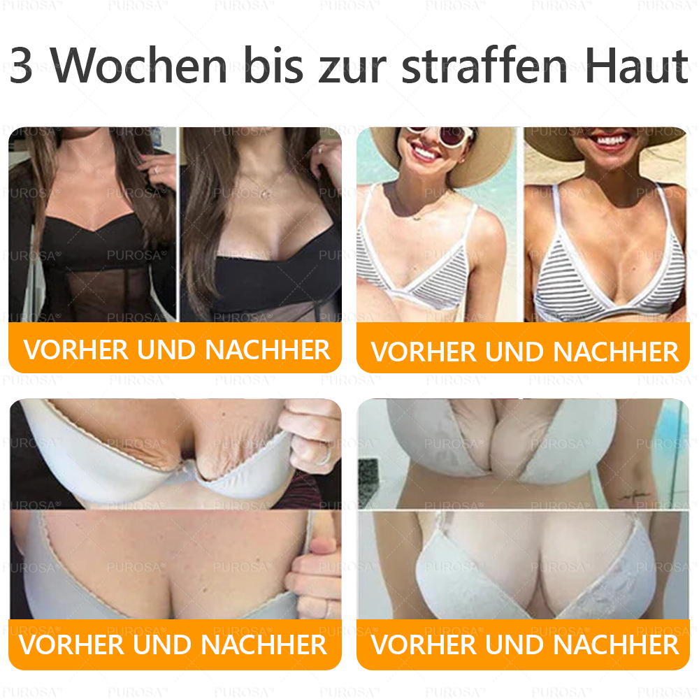 Hergestellt und versendet aus Deutschland ✨VLSVLS® BIENENGIFT Hautregenerationscreme 🔥 LETZTER TAG 80 % RABATT🌟