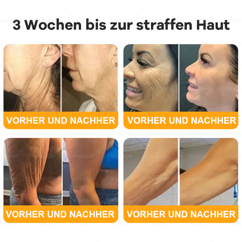 Hergestellt und versendet aus Deutschland ✨VLSVLS® BIENENGIFT Hautregenerationscreme 🔥 LETZTER TAG 80 % RABATT🌟