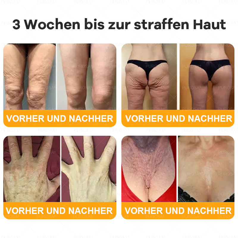 Hergestellt und versendet aus Deutschland ✨VLSVLS® BIENENGIFT Hautregenerationscreme 🔥 LETZTER TAG 80 % RABATT🌟