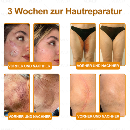 Hergestellt und versendet aus Deutschland ✨VLSVLS® BIENENGIFT Hautregenerationscreme 🔥 LETZTER TAG 80 % RABATT🌟