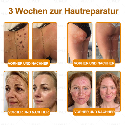 Hergestellt und versendet aus Deutschland ✨VLSVLS® BIENENGIFT Hautregenerationscreme 🔥 LETZTER TAG 80 % RABATT🌟
