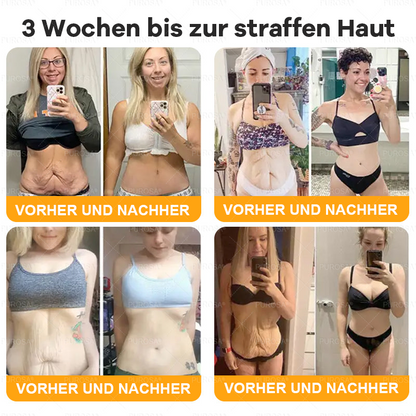 Hergestellt und versendet aus Deutschland ✨VLSVLS® BIENENGIFT Hautregenerationscreme 🔥 LETZTER TAG 80 % RABATT🌟