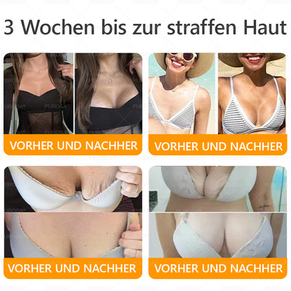Hergestellt und versendet aus Deutschland ✨VLSVLS® BIENENGIFT Hautregenerationscreme 🔥 LETZTER TAG 80 % RABATT🌟