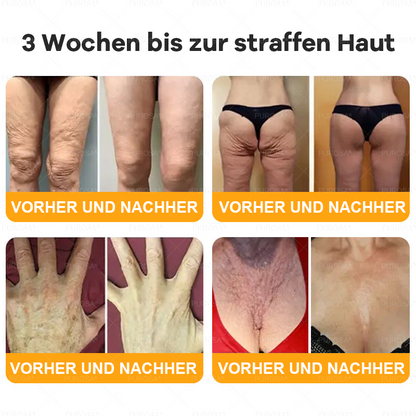 Hergestellt und versendet aus Deutschland ✨VLSVLS® BIENENGIFT Hautregenerationscreme 🔥 LETZTER TAG 80 % RABATT🌟